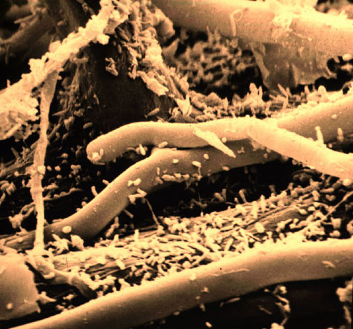 Bacteria dot the surface of strands of fungal hyphae. A ton of microscopic bacteria may be active in each acre of soil. Credit: Michael T. Holmes, Oregon State University, https://lisalapaso.com/2011/02/17/bacteria-in-our-soil/